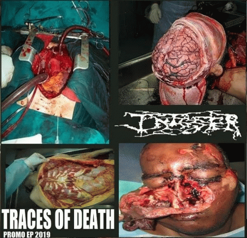 Infester (USA-2) : Traces of Death